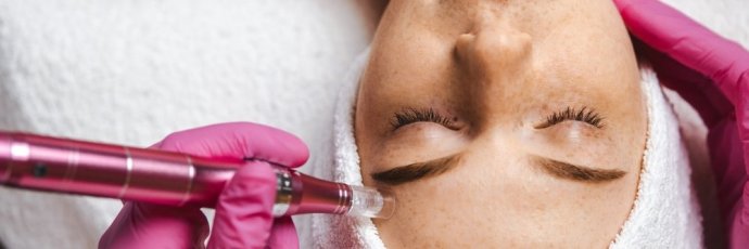 Gesichts-Nano Needling Behandlung - mit dem neuesten Dermapen-Gerät